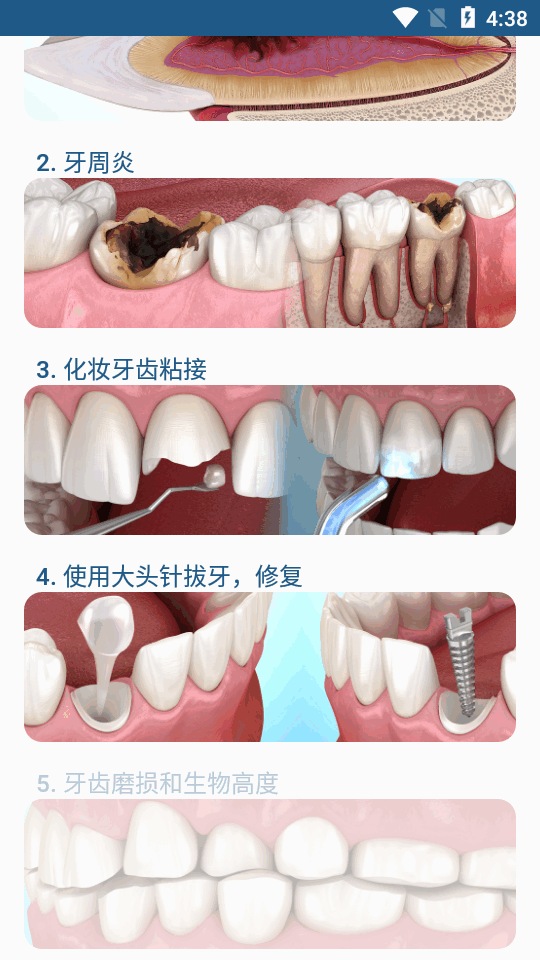 Dental Illustrations